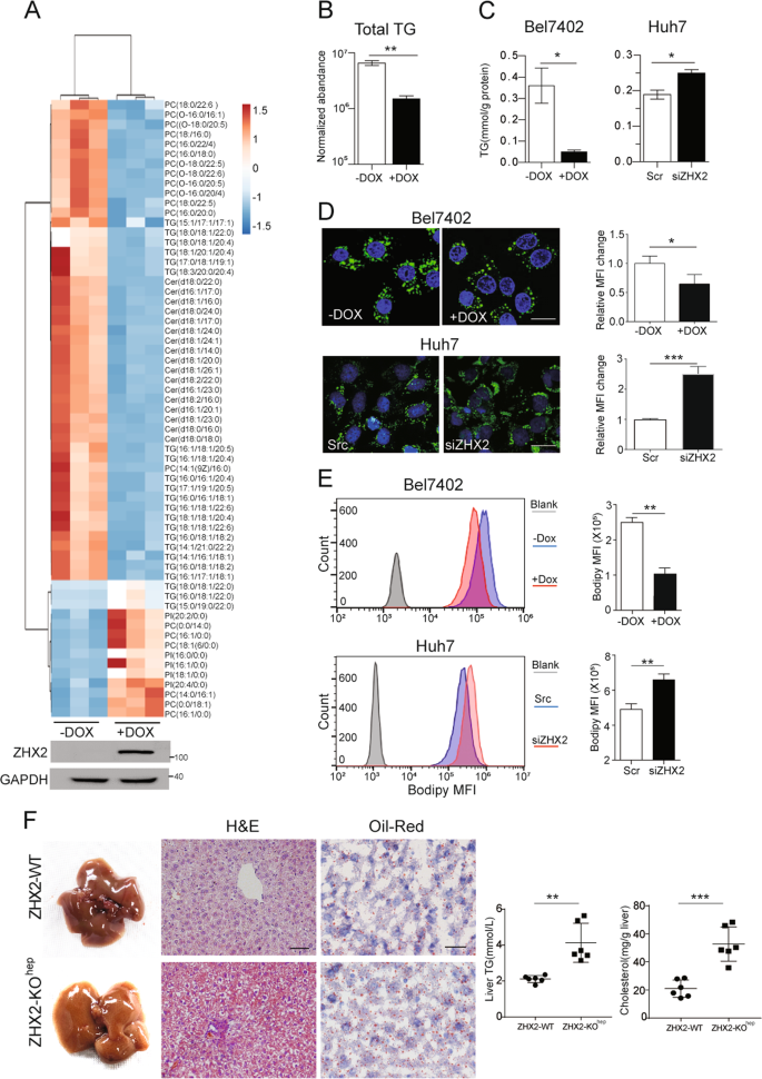 Tumor suppressor ZHX2 inhibits NAFLD-HCC progression via 