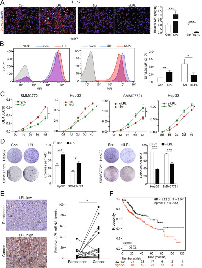 Tumor suppressor ZHX2 inhibits NAFLD-HCC progression via 