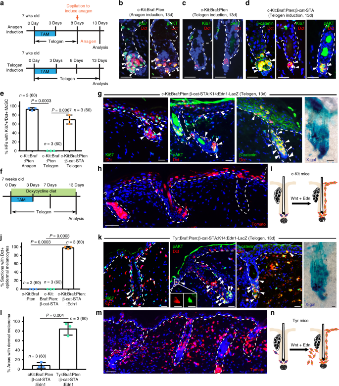 A novel mouse model demonstrates that oncogenic melanocyte 