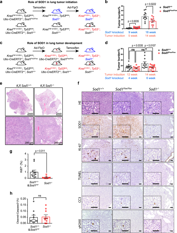Download SOD1 regulates ribosome biogenesis in KRAS mutant non-small cell lung cancer | Nature Communications