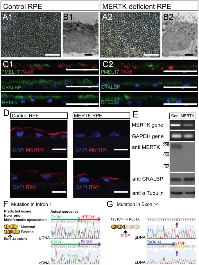 Mertk Rpe Rescue of the MERTK phagocytic defect in a human iPSC disease model ...