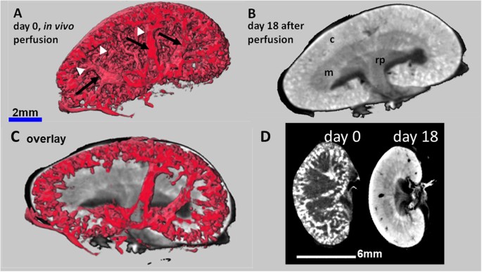 3D virtual histology of murine kidneys –high resolution visualization