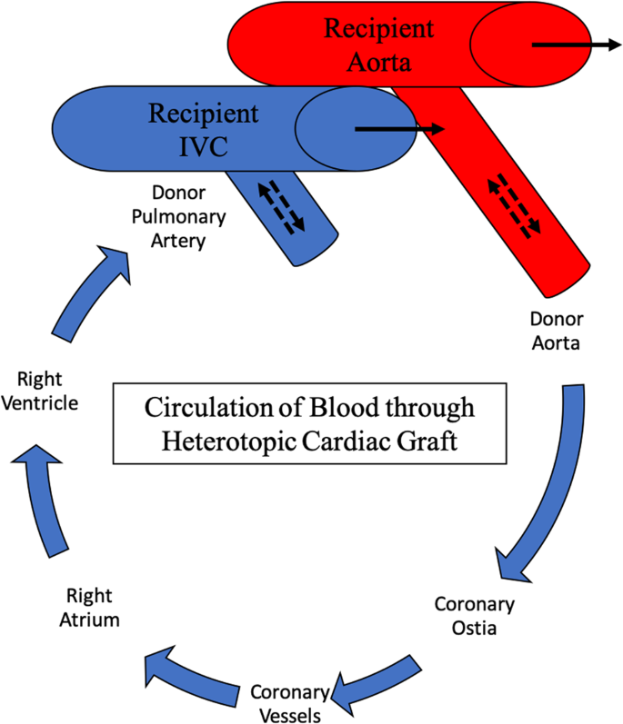 Heterotopic Porcine Cardiac Xenotransplantation in the ...