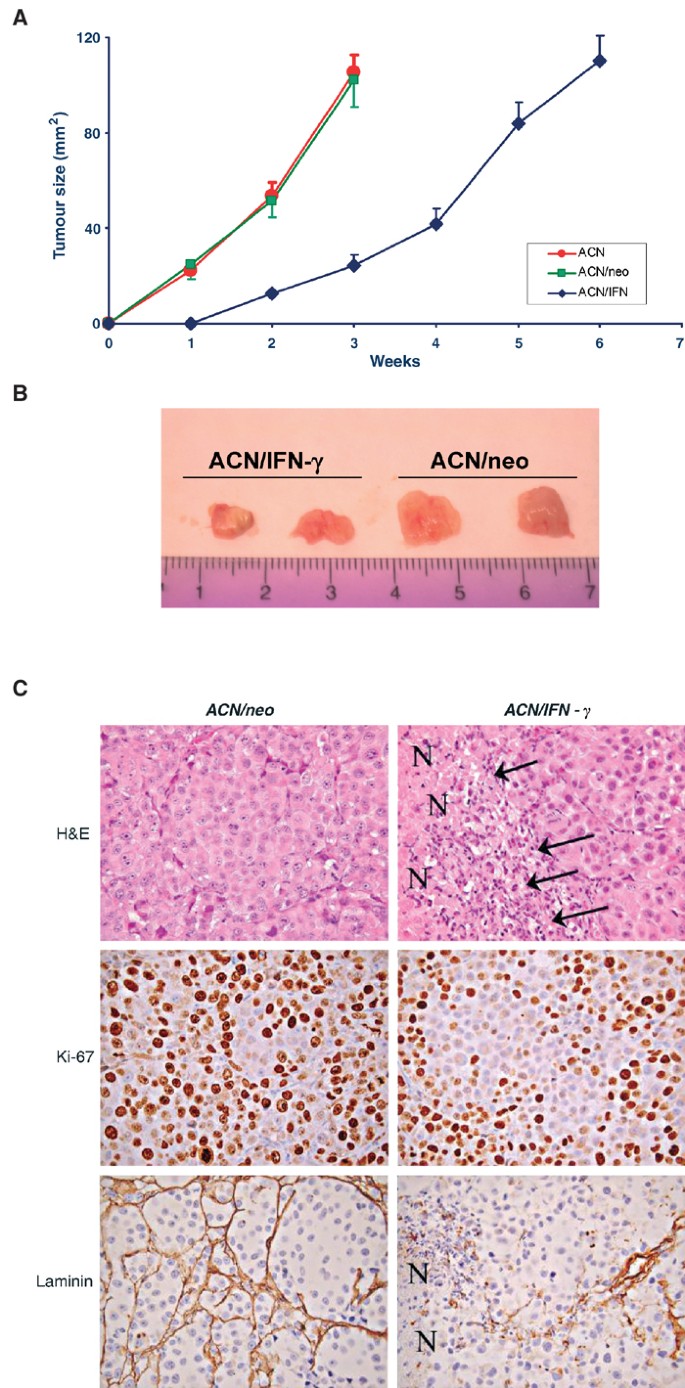 Low-dose interferon- γ- producing human neuroblastoma cells show reduced proliferation and 