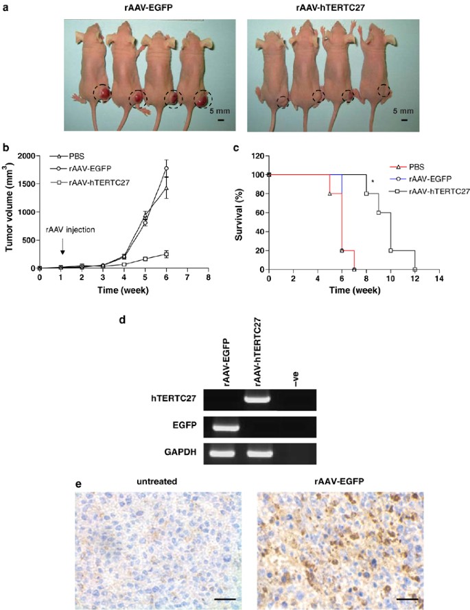 Expression of hTERTC27 and EGFP in U87-MG human 