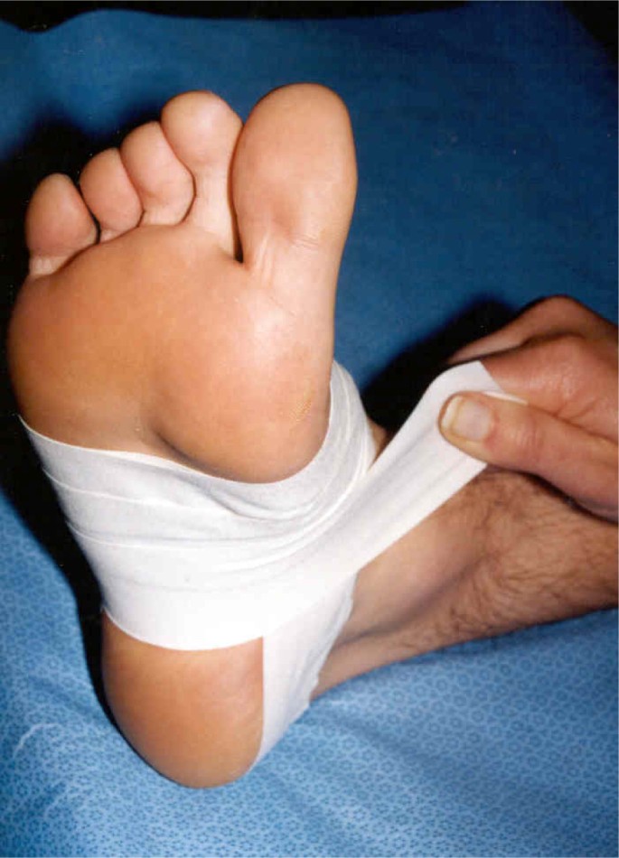 Effectiveness of lowDye taping for the shortterm