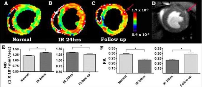 Serial diffusion tensor MRI and tractography of the mouse heart in-vivo ...