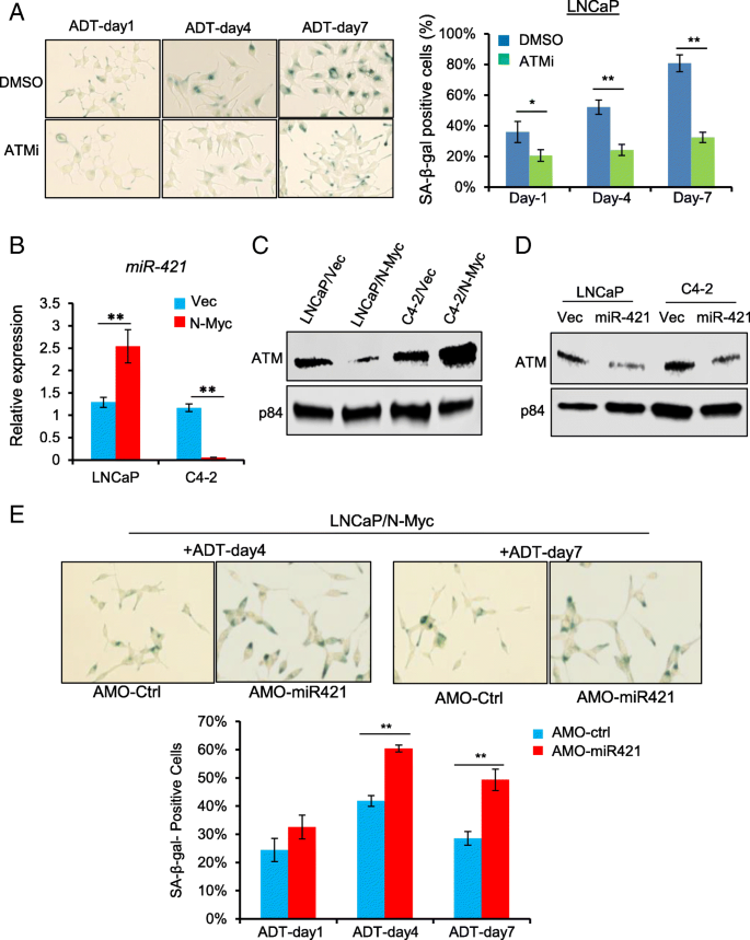 N-Myc confers LNCaP cells ADT resistance and C4-2 cells 