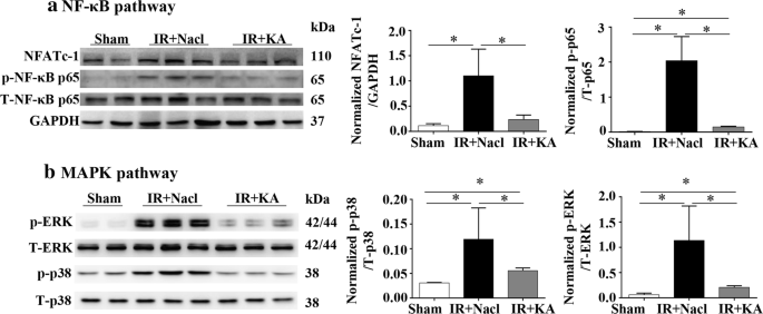 Compound \u03b1-keto acid tablet supplementation alleviates chronic kidney ...