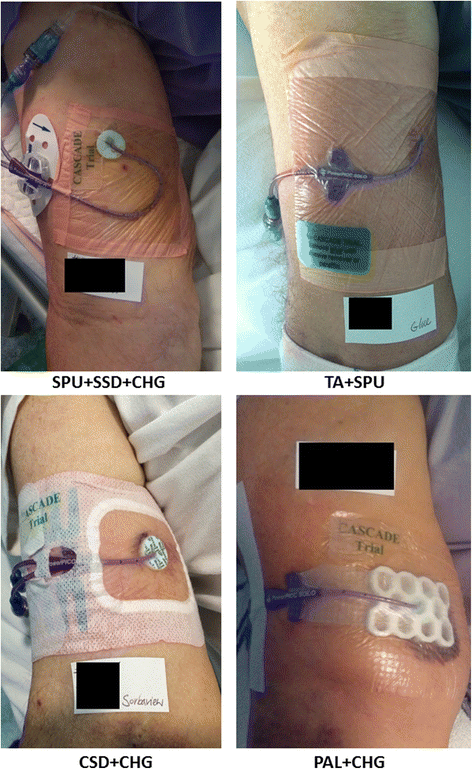 Central venous Access device SeCurement And Dressing ...
