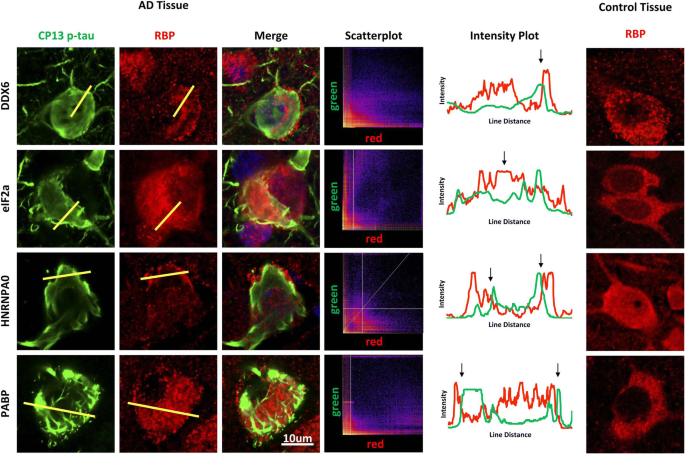 RNA binding proteins co-localize with small tau inclusions ...