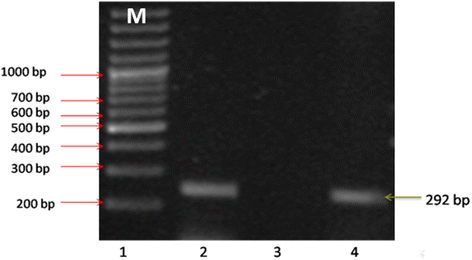 Sex determination from dental pulp DNA among Egyptians - Egyptian Journal of Forensic Sciences ...