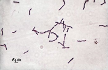 The Family Actinomycetaceae: The Genera Actinomyces, Actinobaculum,  Arcanobacterium, Varibaculum, and Mobiluncus | SpringerLink