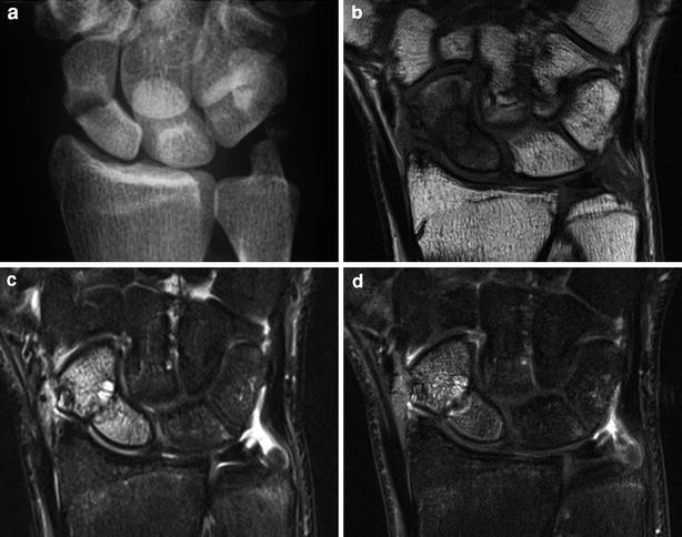 figure 23