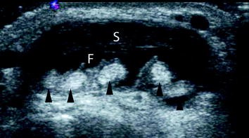 figure 24