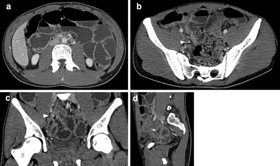 figure 21