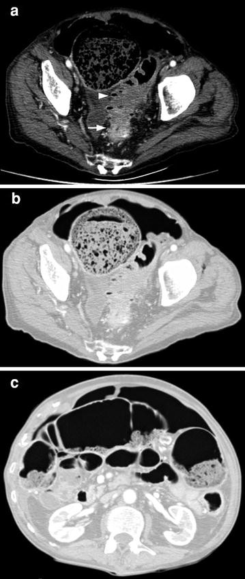 figure 36