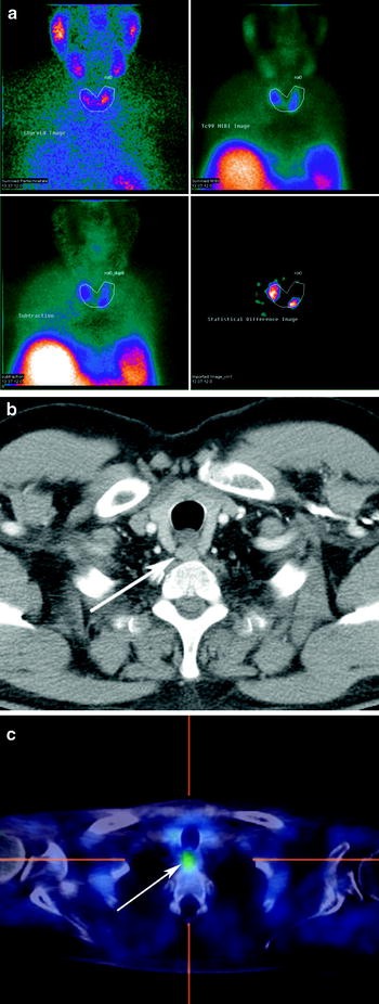 figure 31