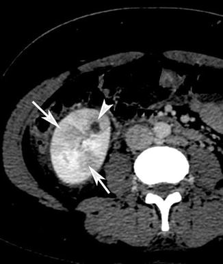 figure 35