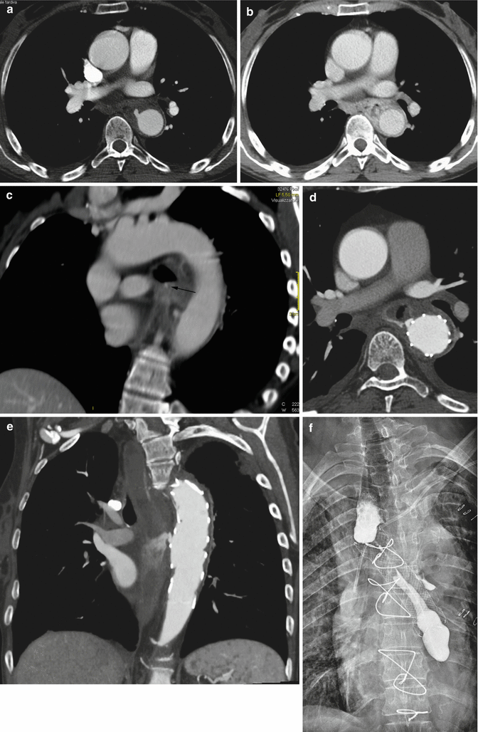 figure 22