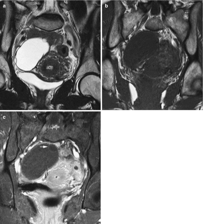 figure 16