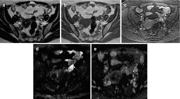 figure 30