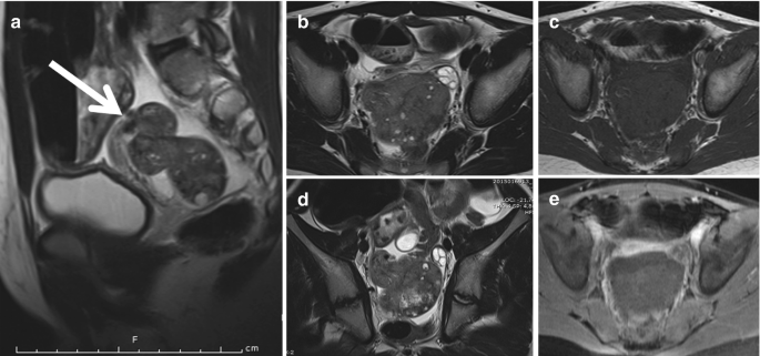 figure 31