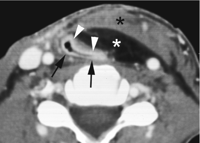 figure 25