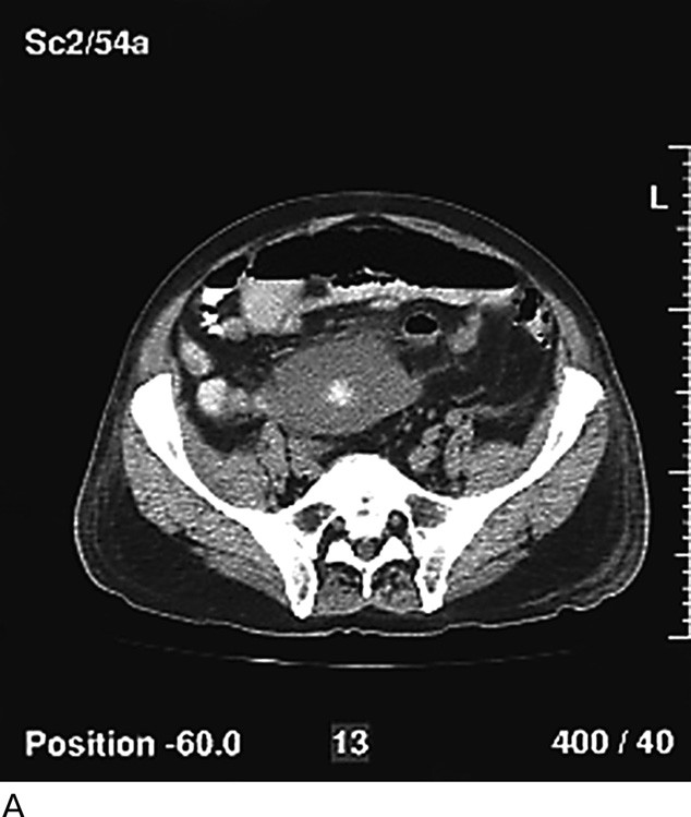 figure 2_18