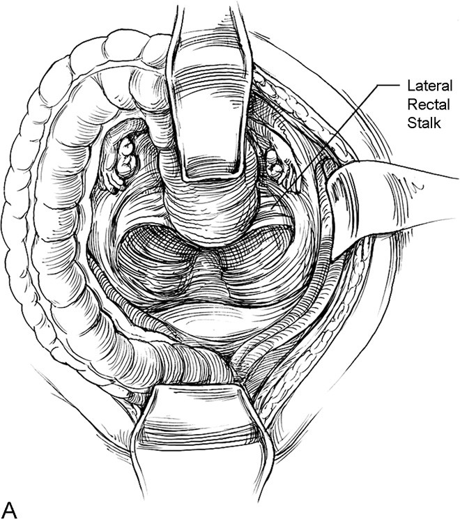 figure 6_47