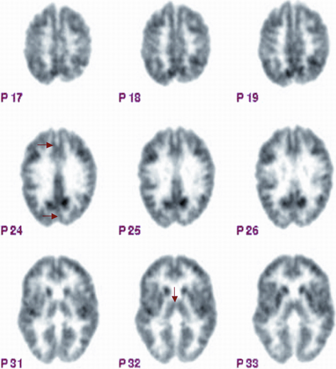 figure 2_2