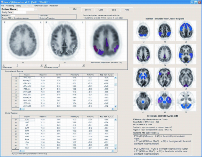 figure 6_2