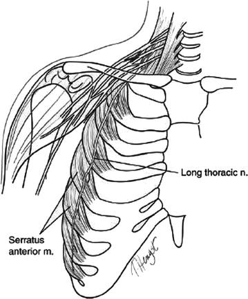 Thoracic Outlet Compression Syndrome and Its Surgical Treatment Modalities