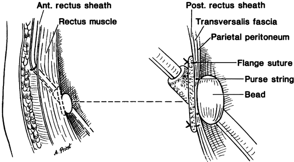 figure 14_30_978-0-387-78940-8