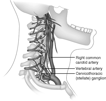 mandibular-nerve-division-and-its-relationship-with-vascular-structures-close  - NYSORA