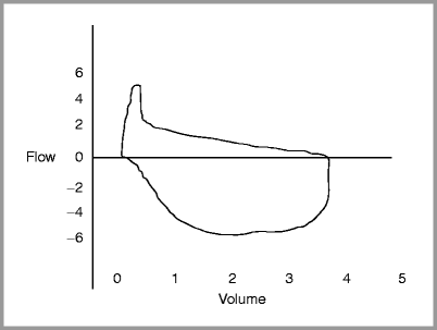 figure 5_23