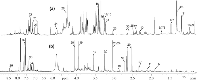 A 1D-NMR spectrum of CSF from a 30d pig, representative of all the