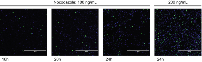 HN1 overexpression after Nocodazole Block (post-G2) using transient