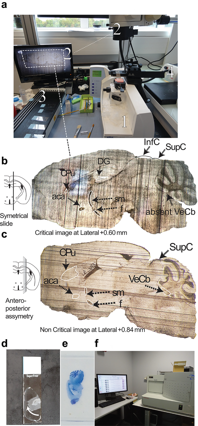 Large-scale neuroanatomical study uncovers 198 gene associations in mouse  brain morphogenesis