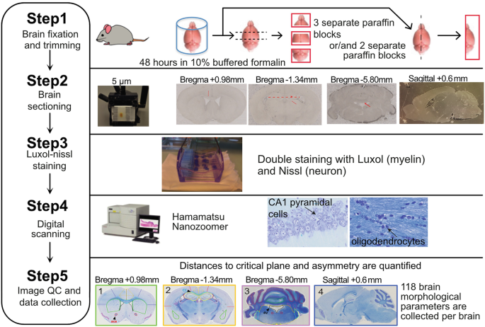 Large-scale neuroanatomical study uncovers 198 gene associations in mouse  brain morphogenesis