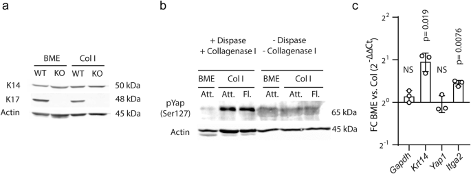 3 images display the results of protein and R N A expression analysis from organoids that grow and invade the different 3 D E C M, labeled a to c.