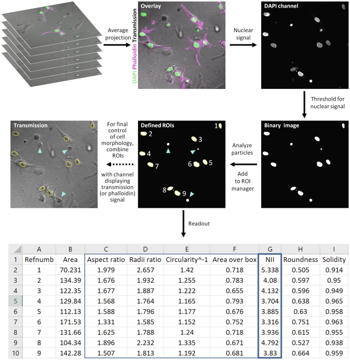 Six micrographs and a table depict nuclear shape quantification in cell culture after the following stages: average projection, nuclear signal, nuclear signal threshold, particle analysis, and R O I addition, read out, and transmission.