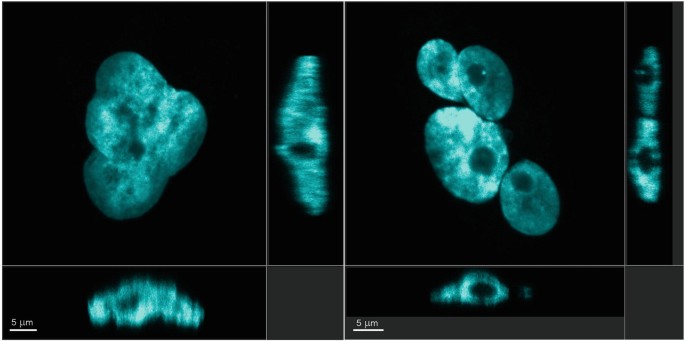 Few laser scanning confocal images. Untreated cells on the left contain a single nucleated cell. Multinucleated cells are observed on the right.