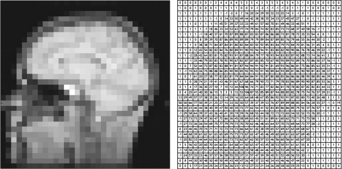 2 images. 1. A blurred image of the human brain. 2. An image displays organized rows of numbers that vaguely outline the blurred image of the human brain.
