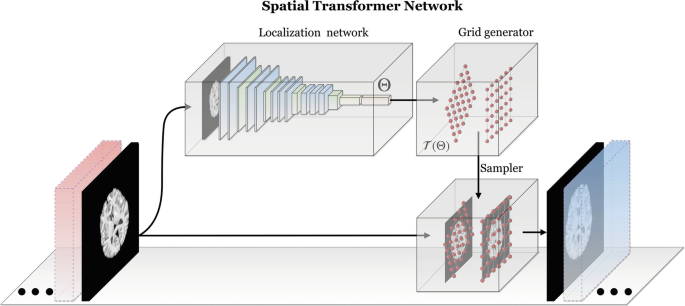 A schematic diagram of a spatial transformer network. The localization network predicts the transformation parameters through different layers, the grid generator creates two grids, and the sampler extracts pixels from the input image, and generates output.