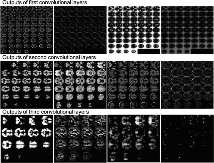 Three rows of brain images. Each has four images. The first row is labeled the output of the first convolutional layers. The second row is labeled the outputs of the second convolutional layer, and the third row is labeled as the outputs of the third convolutional layer.