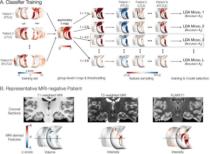 2 illustrations. 1. Classifier training is labeled training set, thresholding, feature sampling, and model selection. 2. Representative M R I-negative patient. It has coronal sections and M R I-derived features.