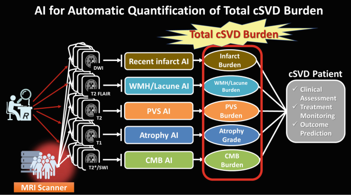 A flow chart. A horizontal hierarchy depicts the use of A I for automatic quantification of the total C S V D burden. 5 burdens are corresponding to 5 A I.