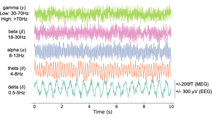 A signal graph exhibits the time in seconds value for gamma with a low of 30 to 70 hertz and a high of greater than 70 hertz. Beta 18 to 30 Hertz. Alpha 8 to 13 Hert. Theta 4 to 8 Hertz. Delta 0.5 to 5 Hertz.