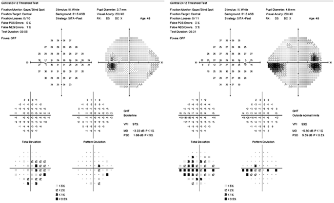 Snellen chart, Psychology Wiki